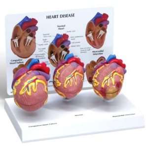    3 Piece Mini Heart Models Set Model#AW 255 