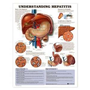  Understanding Hepatitis Anatomical Chart Unmounted 9992PU 