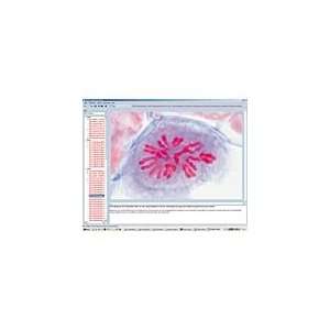 Illustrated Resource Library   Cell Division (Mitosis and Meiosis) CD 