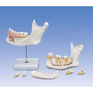  6 Part Half Lower Jaw Model 3 Times Life Size Health 