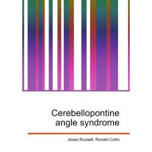  Cerebellopontine angle syndrome: Ronald Cohn Jesse Russell 