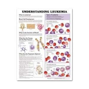  Understanding Leukemia Anatomical Chart: Industrial 