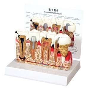 GPI Anatomical Dental Teeth Model:  Industrial & Scientific