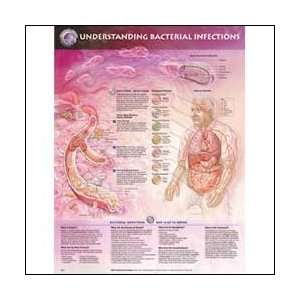  Understanding Bacterial Infections Anatomical Chart 20 X 
